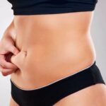 shape of the prefect body after cool sculpting pressure